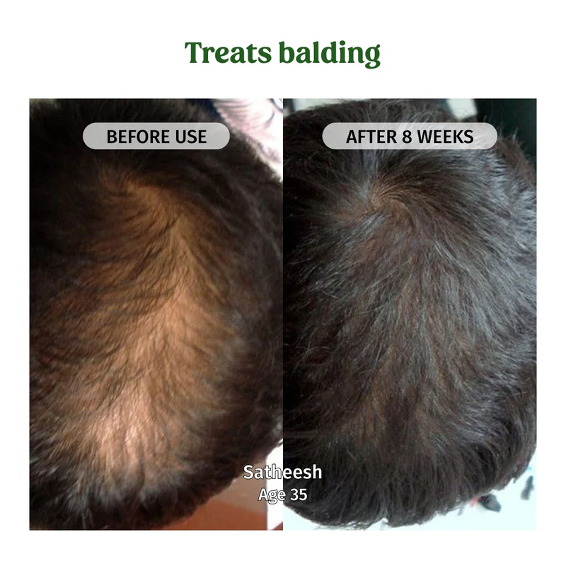 Product image 4 | Indian product Online Shopping Store